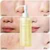 OEM ODM Beauty Black Head Makeup Remover Gel Cream Balm Facial Product Skin Care Serum Pore Cleanser Green Tea Extract Face Wash