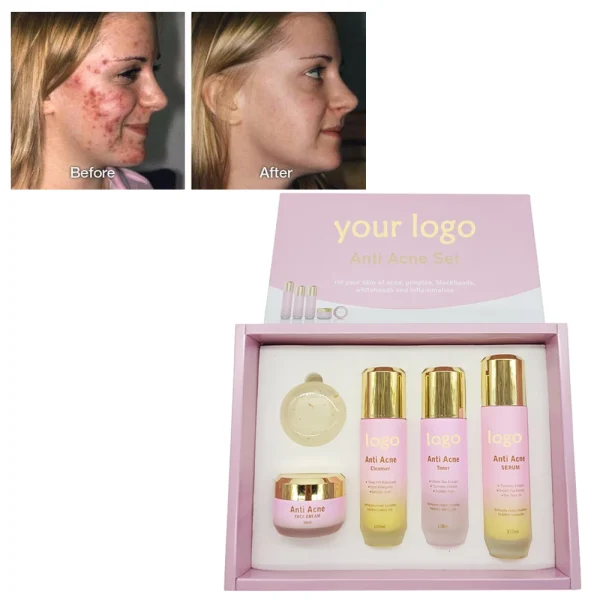 Private Label Customized logo Skin Care Set Anti Acne Skin Care Products for Anti Acne SkinCare Set