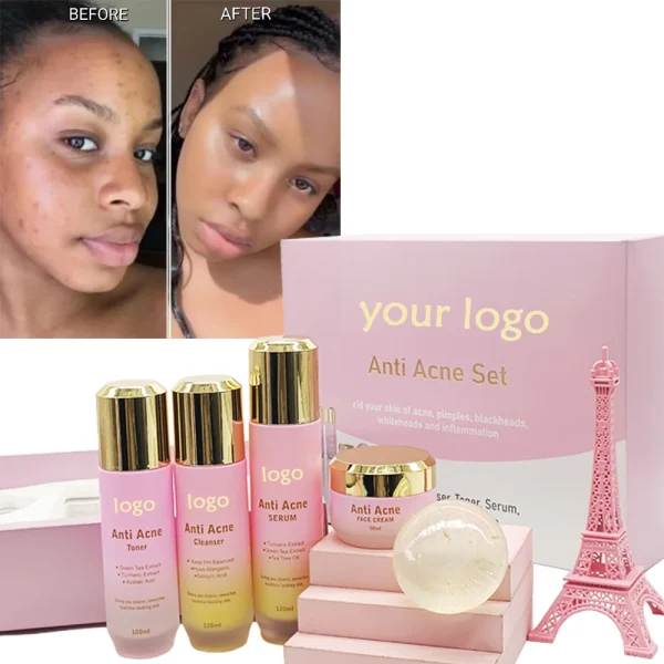 Private Label Customized logo Skin Care Set Anti Acne Skin Care Products for Anti Acne SkinCare Set