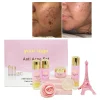Private Label Customized logo Skin Care Set Anti Acne Skin Care Products for Anti Acne SkinCare Set
