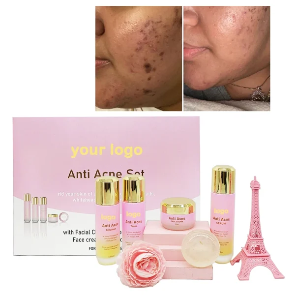 Private Label Customized logo Skin Care Set Anti Acne Skin Care Products for Anti Acne SkinCare Set