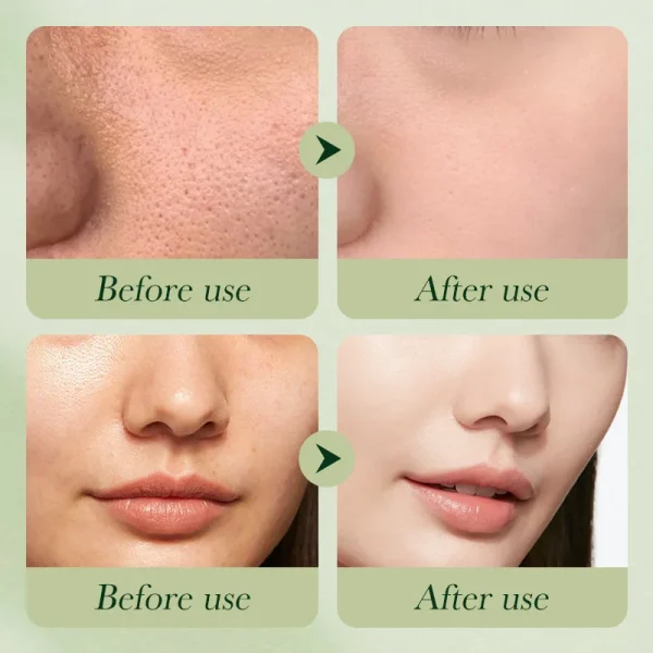 Private Logo Beauty Organic Serum Avocado Lightening Whitening Set Skincare Products Lotion Moisturizer Face Wash Skin Care Set