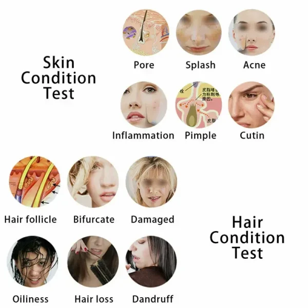 50X/200X Magnifying Skin Analyzer Beauty Products Rechargeable Hair Analyzer Oil Moisture Pigment Scalp Scanner Detector 50X/200X Magnifying Skin Analyzer Beauty Products Rechargeable Hair Analyzer Oil Moisture Pigment Scalp Scanner Detector